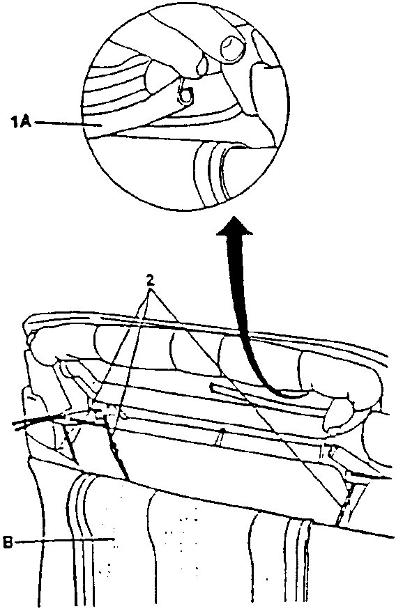 Close-up showing disconnection of clips from elastic bands, cables and tie rods (1A) from structure (1B).