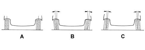 WHEEL GEOMETRY