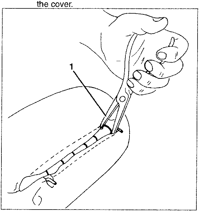 Hand using special pincers to reposition metal clips holding a cover on a car's headrest area.