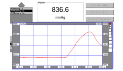 TURBOCHARGING PRESSURE CHECK