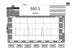VARIABLE GEOMETRY TURBOCHARGER ACTUATOR LEAKAGE TEST