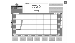 WASTE GATE VALVE PRESSURE CHECK