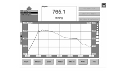 TURBOCHARGING PRESSURE CHECK