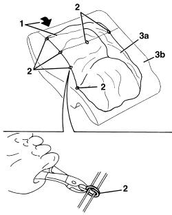RIGHT rear seat BACKREST COVER , (individual) - R.R.