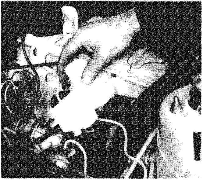Hand removing the brake fluid reservoir from the master cylinder