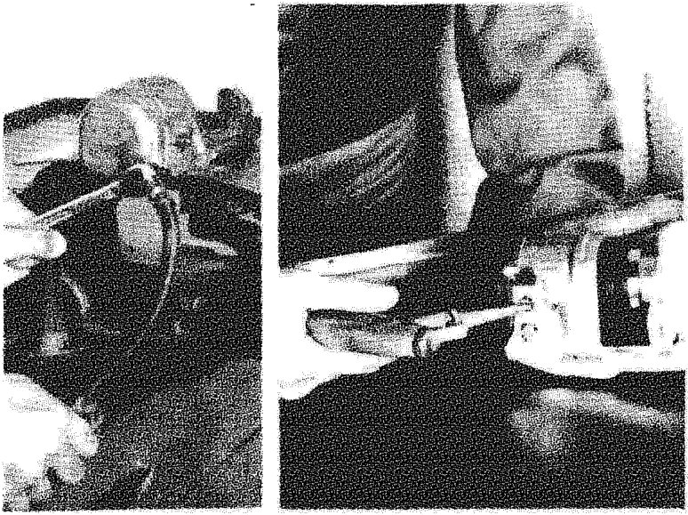 Hands using a tool to remove the brake caliper assembly from the vehicle