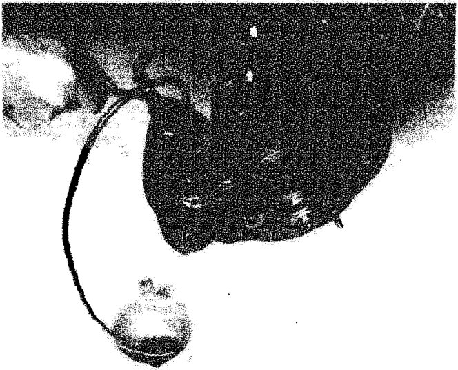 A hand holding a clear container collecting fluid from a bleed nipple on the brake assembly.