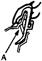 Diagram showing clip A and arrow indicating removal direction